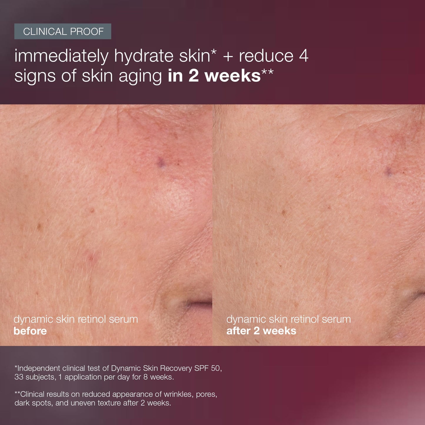 Dark Salmon Dermalogica Skin Aging Solutions Kit, Anti Aging Skincare Set - Includes: Face Cleanser, Serum, Moisturizer with SPF, and Cream, Travel Size