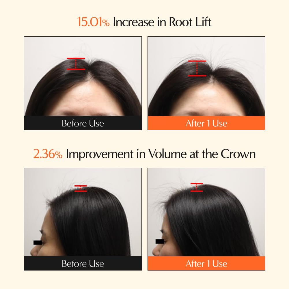 Seashell lilyeve GrowTurn 3D Volume Shampoo with Built-in Brush – For Thinning Hair & Fuller-Looking Volume, Hair loss, Gentle Scalp Care | 6.76 Fl Oz
