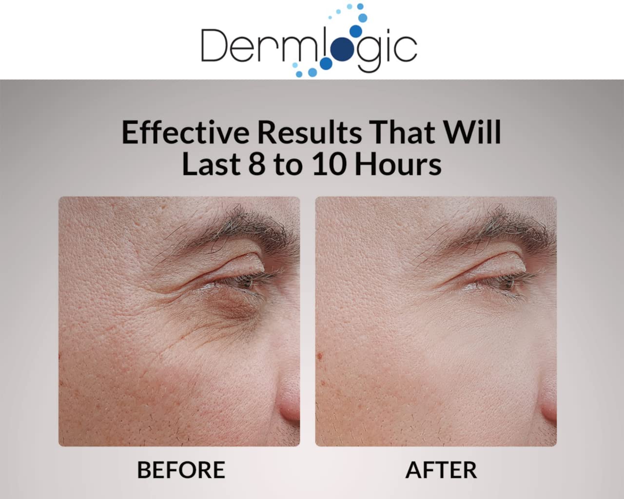 White Smoke Under Eye Puffiness & Dark Circles Rapid Treatment- Instantly Reduces the Appearance of Puffy Eye Bags, Crow’s Feet, & Sagging Skin.