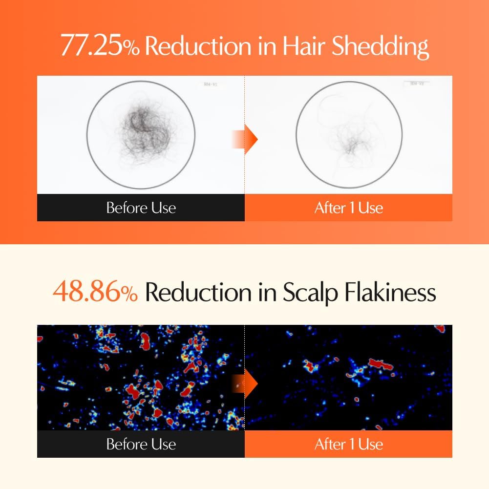 Seashell lilyeve GrowTurn 3D Volume Shampoo with Built-in Brush – For Thinning Hair & Fuller-Looking Volume, Hair loss, Gentle Scalp Care | 6.76 Fl Oz