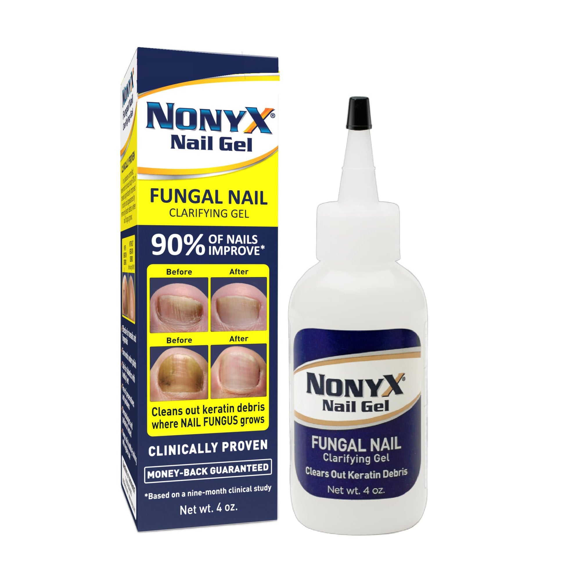 White Smoke NONYX Fungal Nail Clarifying Gel | Clinically Proven for Discolored, Thick, Brittle, Yellow, Lifted, and other signs of Fungus-Damaged Toenails | 90% of Nails Improve | Over 8 million sold