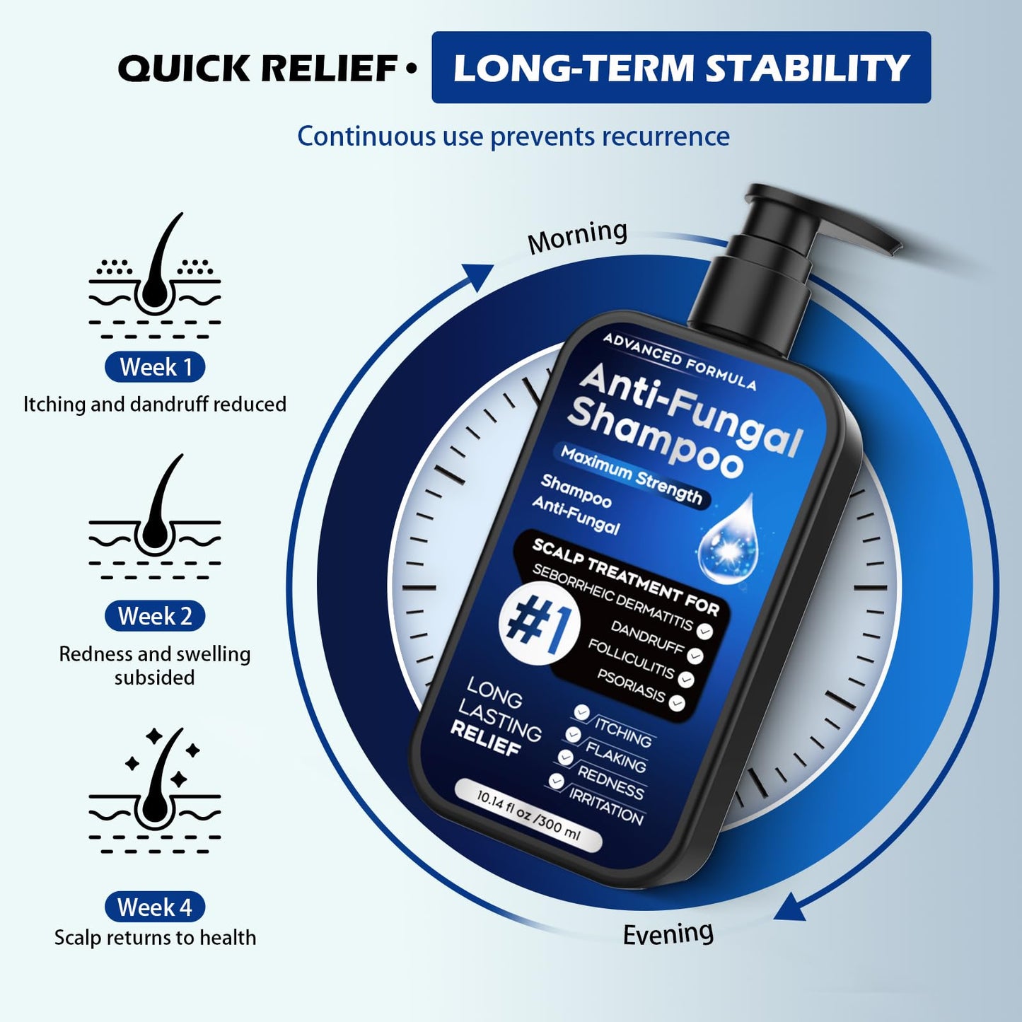 Alice Blue Antifungal Psoriasis Shampoo for Seborrheic Dermatitis, Folliculitis & Scalp Psoriasis, Anti-Dandruff Shampoo for Men & Women, Relieves Scalp Itching, Dryness, Sulfate & Paraben-Free, 10.1 Fl Oz-Fresh