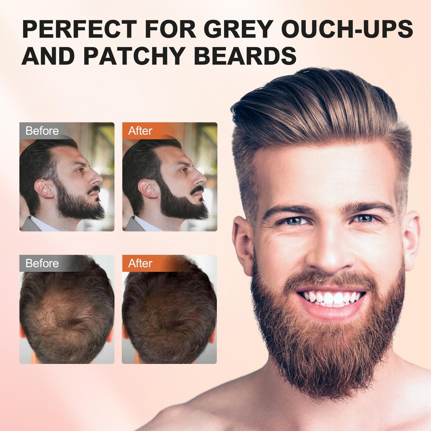 Misty Rose Acosexy Root Touch Up Powder - Instant Gray Hair Coverage for Hairline, Eyebrows, Men's Beard, and Bald Spots