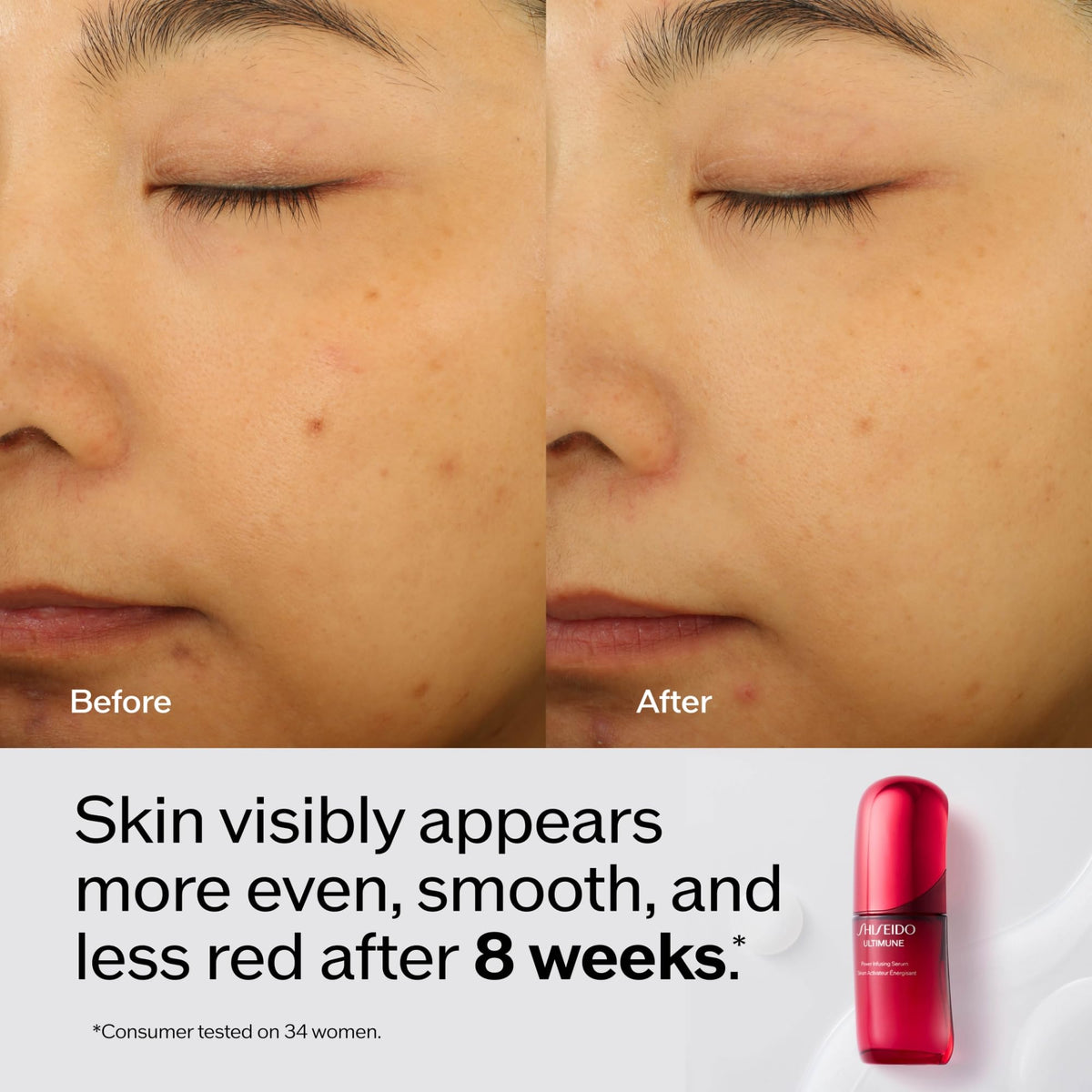 Tan Shiseido Correct & Prevent Set - Clarifying Cleansing Foam (50mL), Eudermine Activating Essence (70mL) Ultimune Power Infusing Serum (75mL) & Vital Perfection Advanced Cream (15mL) - $266 Value