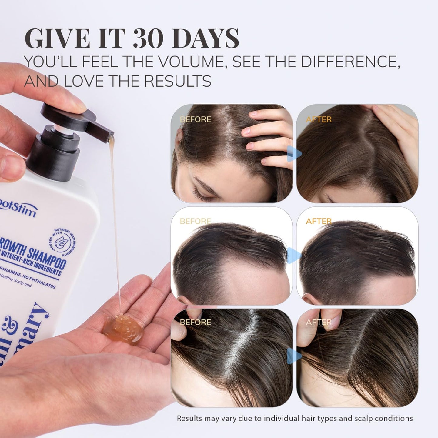 Lavender Biotin & Rosemary Shampoo for Hair Growth: Hair Loss Shampoo for Thinning Hair Infused with Natural Nutrient Rich Ingredients for Hair thickening Sulfate Free 10 fl oz