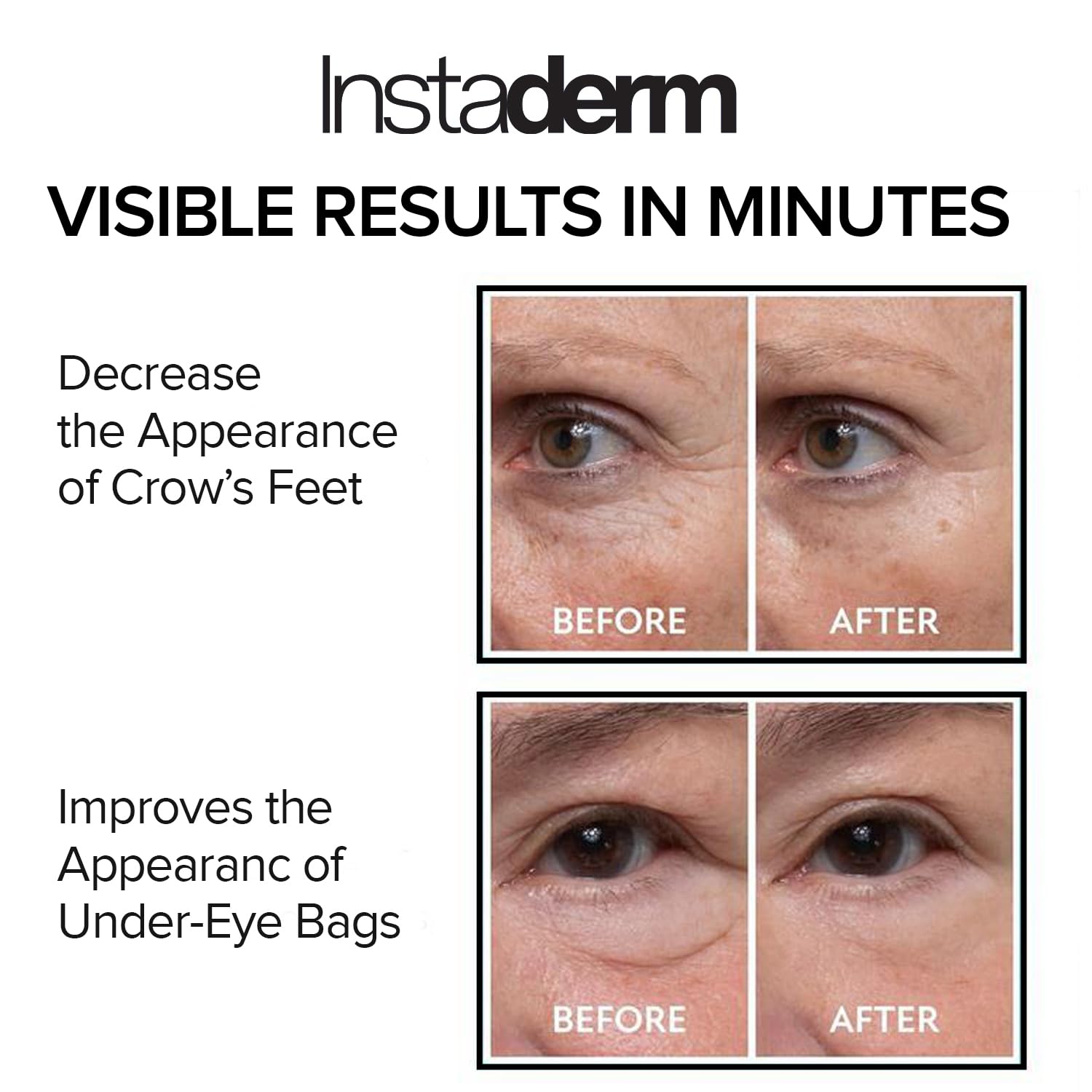 White Smoke Instant Eye Tightener – Instantly Reduces Under Eye Bags, Puffiness, Dark Circles, Wrinkles & Crow's Feet. Naturally Ageless Hydrating Cream. Disappears Before Your Eyes Within Minutes.
