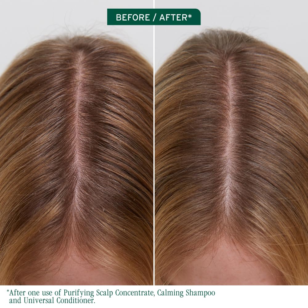 Dark Olive Green Biolage Scalp Sync Purifying Concentrate - Exfoliating & Clarifying Dry Scalp Treatment, Refreshing & Reinvigorating, Fermented Tea Blend & Glycolic Acid