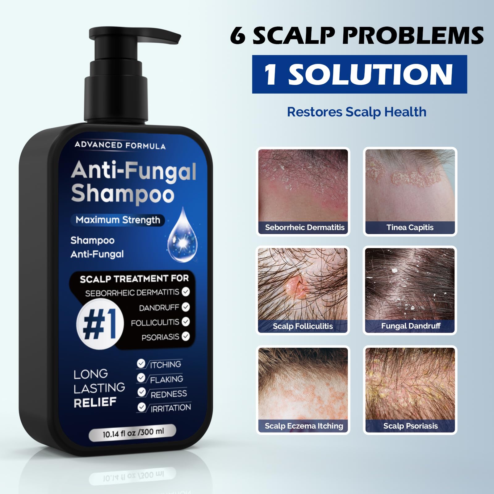 Alice Blue Antifungal Psoriasis Shampoo for Seborrheic Dermatitis, Folliculitis & Scalp Psoriasis, Anti-Dandruff Shampoo for Men & Women, Relieves Scalp Itching, Dryness, Sulfate & Paraben-Free, 10.1 Fl Oz-Fresh