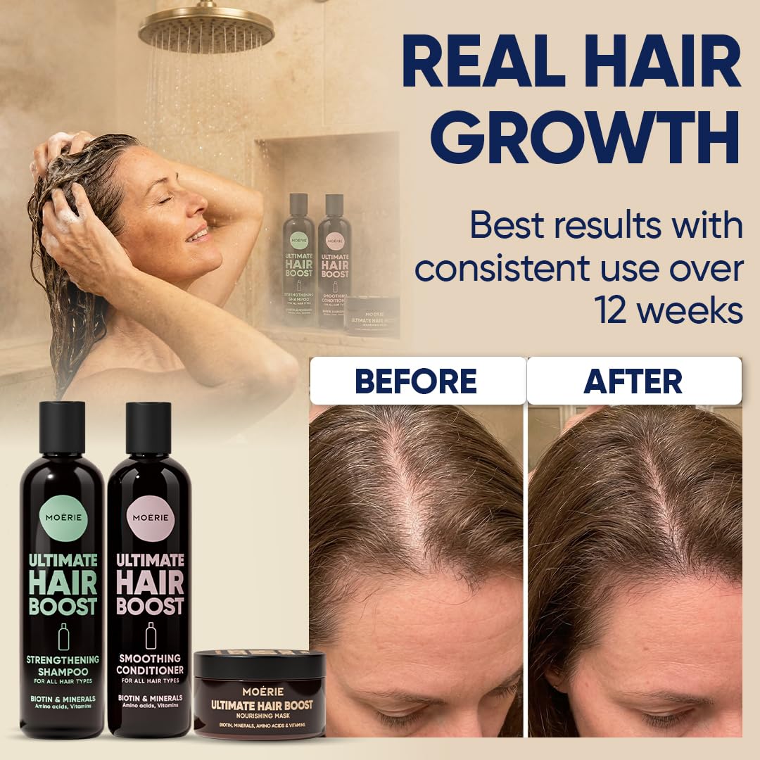 Light Gray Moérie Hair Growth Shampoo, Conditioner and Mask - Hair Loss Solution with Biotin and Rosemary, Thickening Hair Regrowth Set for Thinning Hair - Ultimate Hair Growth Care (Double Set)