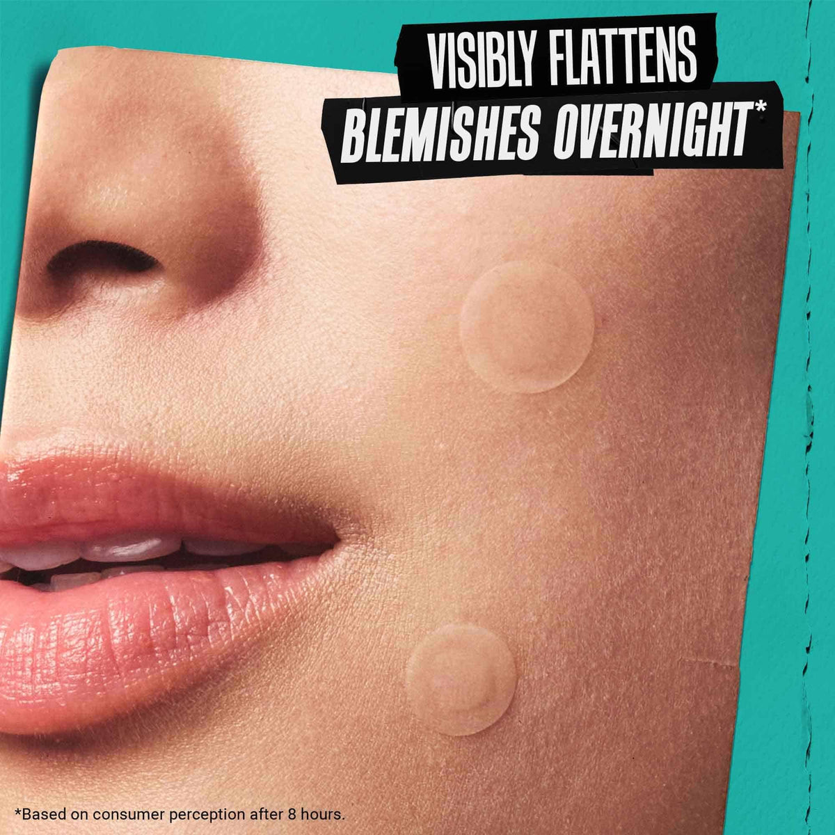 Sienna Kiehl's - Overnight Pimple Patches - Invisible Blemish Patch - 22 Count