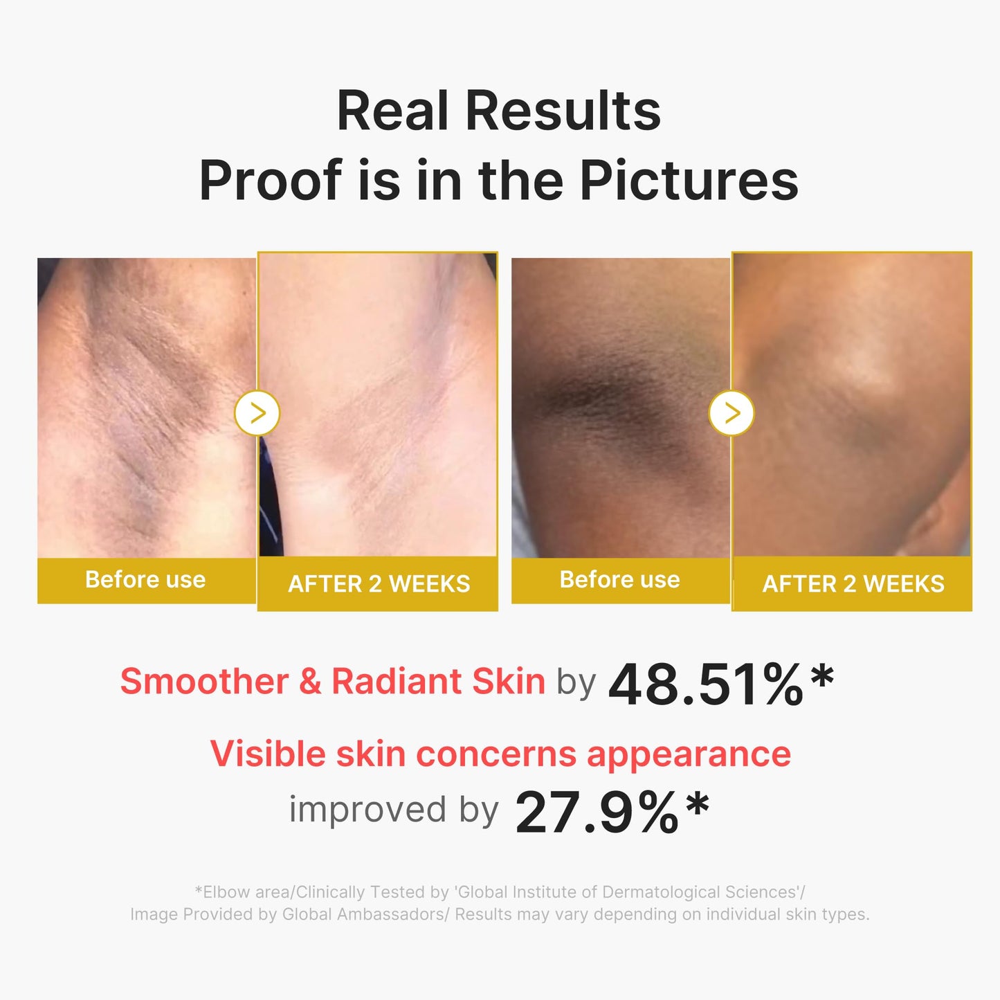 White Smoke medicube Body Peel Shot with Kojic Acid and Turmeric | Gentle Body Brightening & Exfoliating Serum with BHA, LHA & PHA for Dead Skin Cells, Uneven Looking Skin & Excess Sebum | 9.46 fl.oz