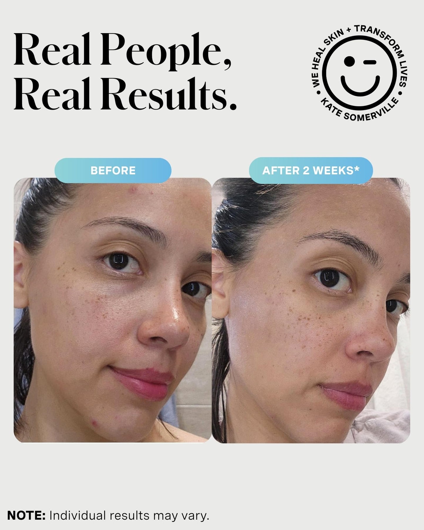 Lavender Kate Somerville EradiKate 3% Sulfur Daily Foaming Cleanser Acne Treatment – Clinically Formulated Medicated Face Wash Balances Skin & Cleans Pores, 4 Fl Oz