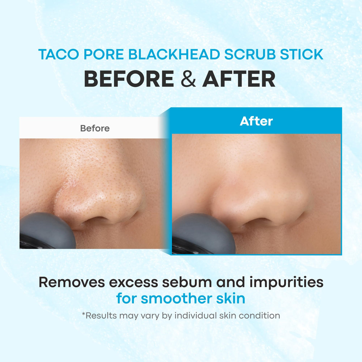 Alice Blue TONYMOLY Tako Pore Black Head Scrub Stick, Easter Basket Stuffer, Deep Cleansing Pore Remover, Characol Blackhead Remover for Face, Nose, Women + Men