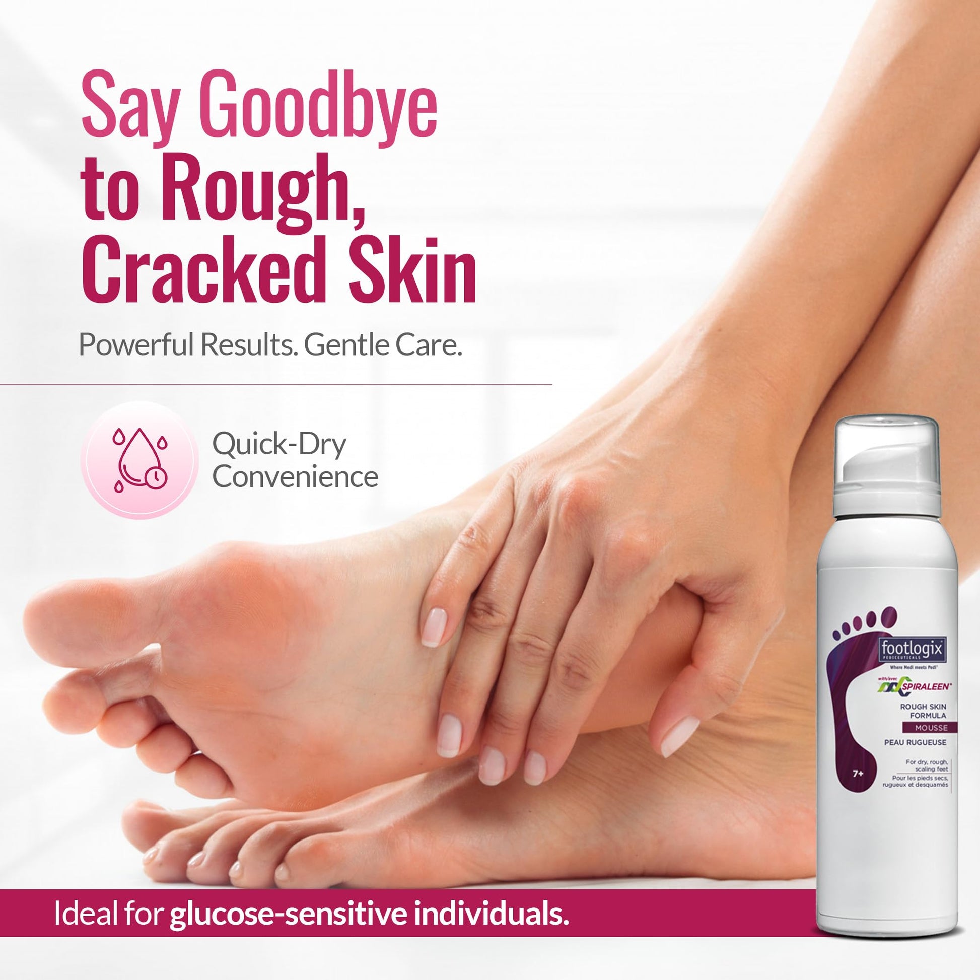White Smoke Footlogix Rough Skin Formula with Spiraleen - Mousse for Dry Cracked Heels and Feet, Foot Care for Men and Women, Dry Cracked Feet Treatment, 4.23oz