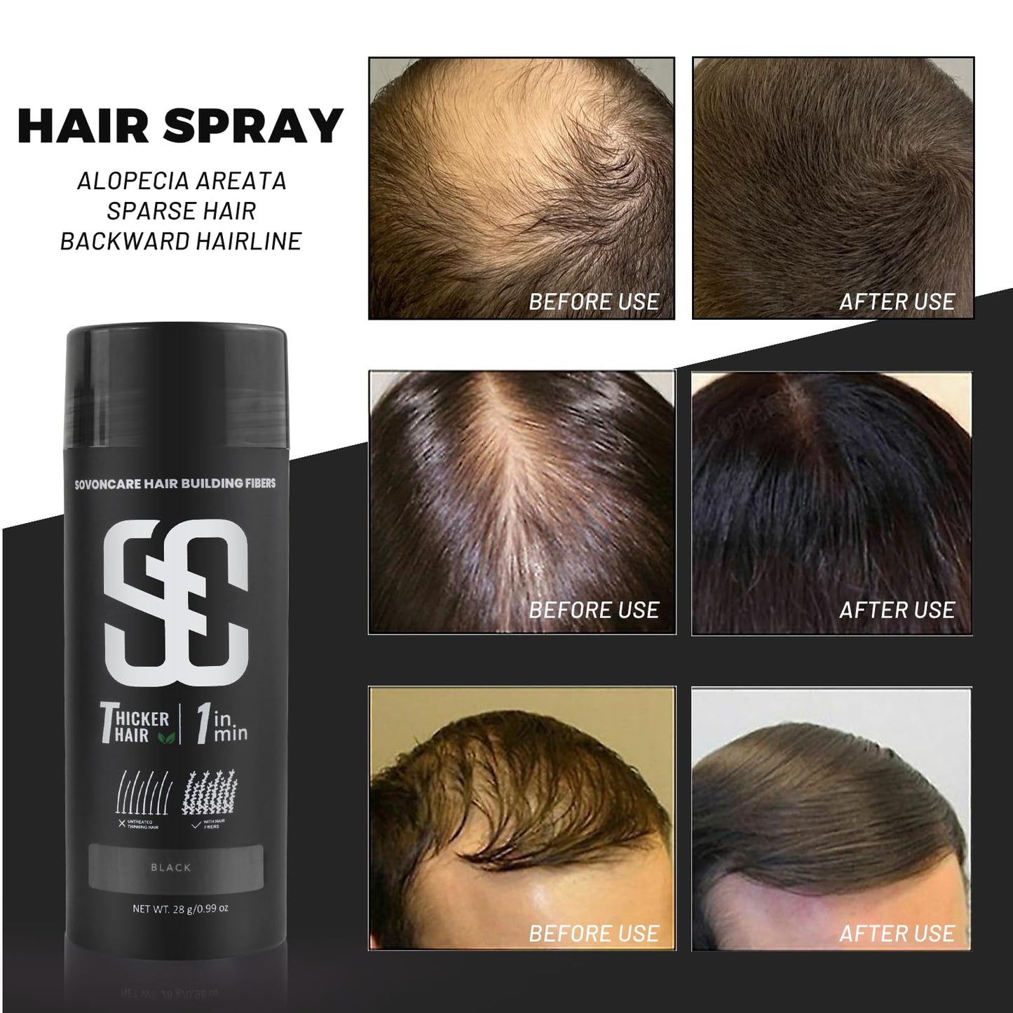 Dark Slate Gray SOVONCARE Hair Fibers for Thinning Hair, Black Hair Building Fibers for Bald Spots Undetectable & Natural, Conceals Hair Loss, Fill In Fine Hair Powder Hair Thicker Instantly for Women & Men 28g
