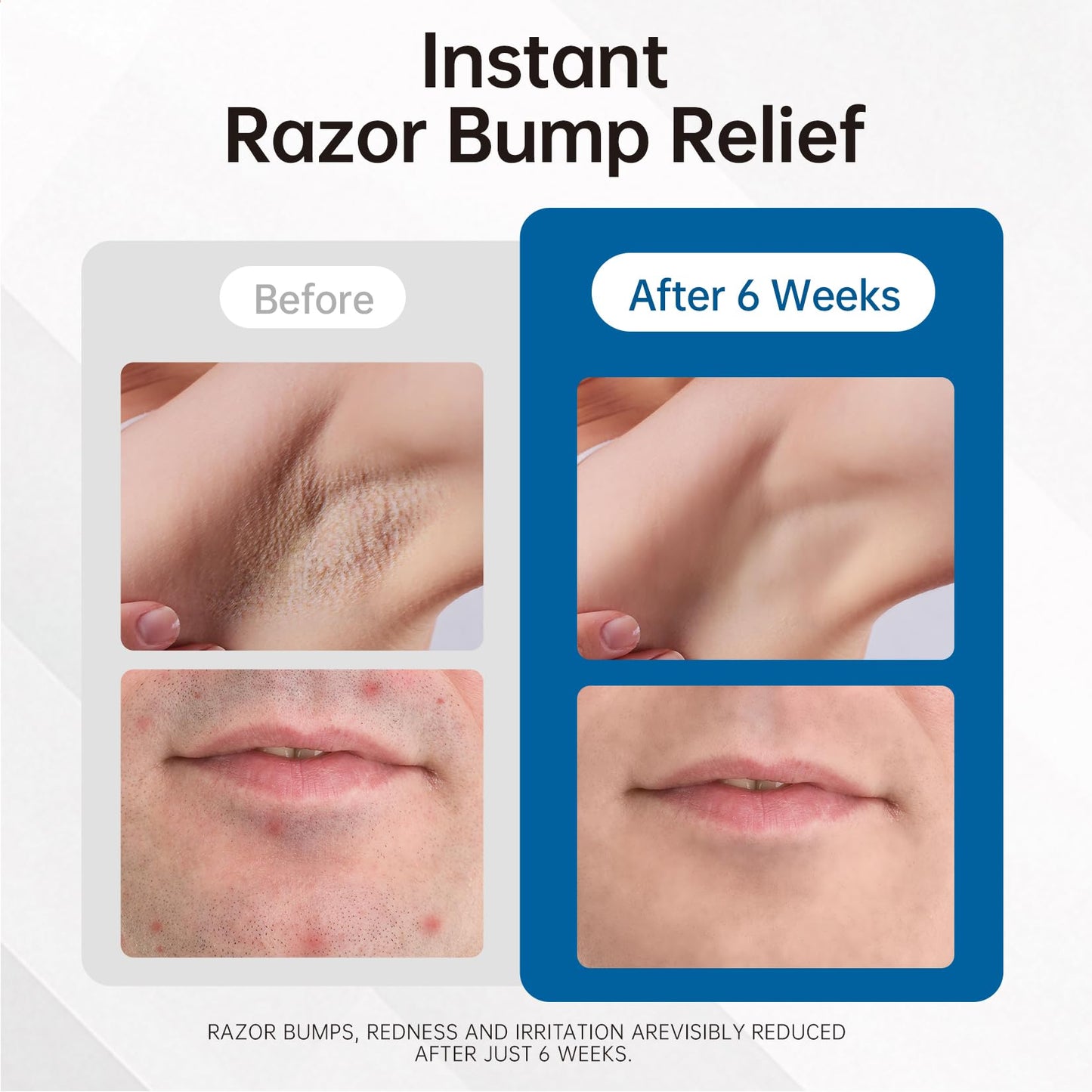 White Smoke Razor Bumps Ingrown Hair Treatment: 3.38fl.oz Smoothing Solution for Body, Beard & Bikini Area Post Waxing After Shaving Serum for Ingrown Hair & Razor Burn - Women & Men