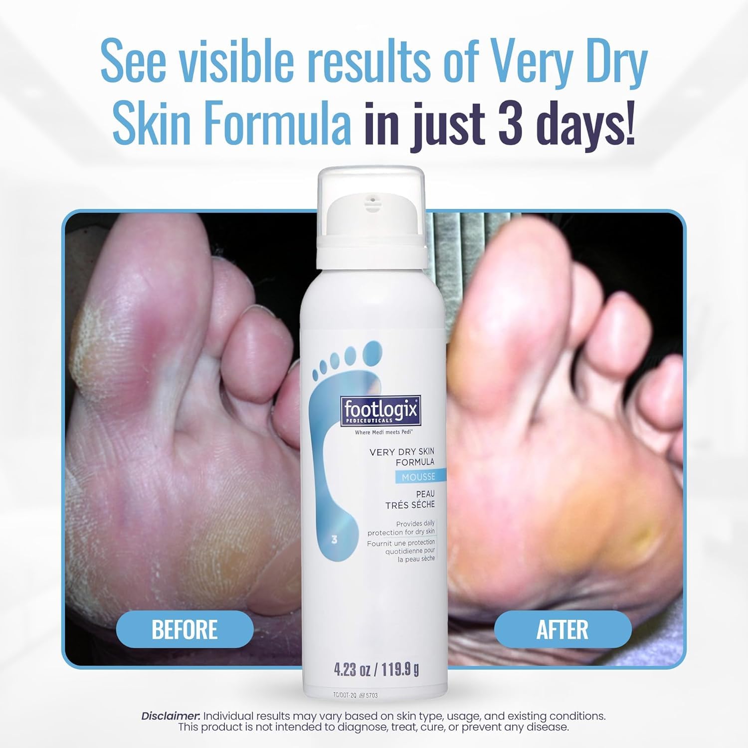 White Smoke Footlogix #03 Very Dry Skin Formula