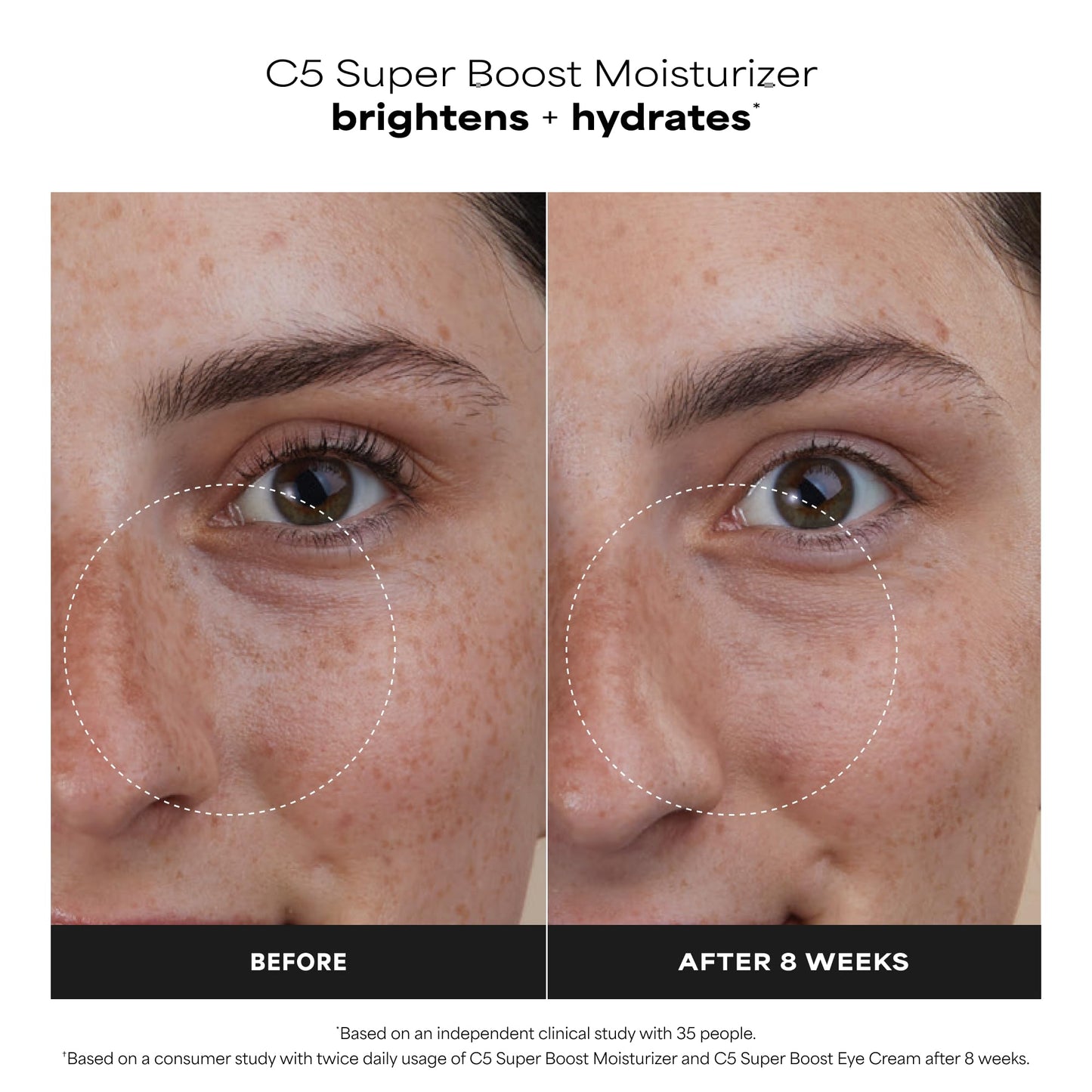 White Smoke Paula's Choice C5 Super Boost Face Moisturizer with 5% Vitamin C & Squalane, Daily Face Lotion for Discoloration, Uneven Tone, Fine Lines & Breakout-Prone Skin, Fragrance-Free, 1.7 Fl Oz
