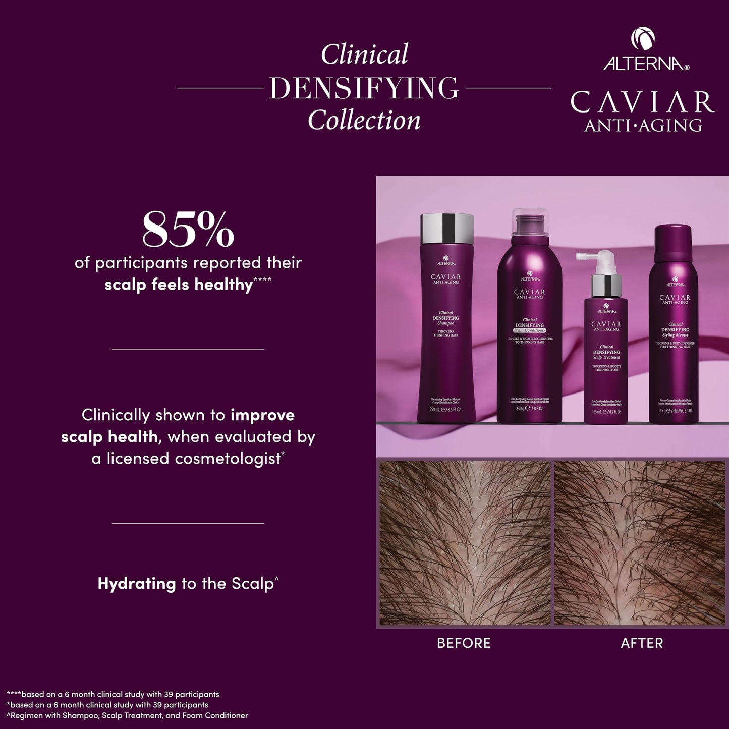 Midnight Blue Alterna Haircare CAVIAR Anti-Aging Clinical Densifying Shampoo 8.5 Fl Oz | For Fine, Thinning Hair | Thickens Hair, Protects Scalp | Sulfate Free