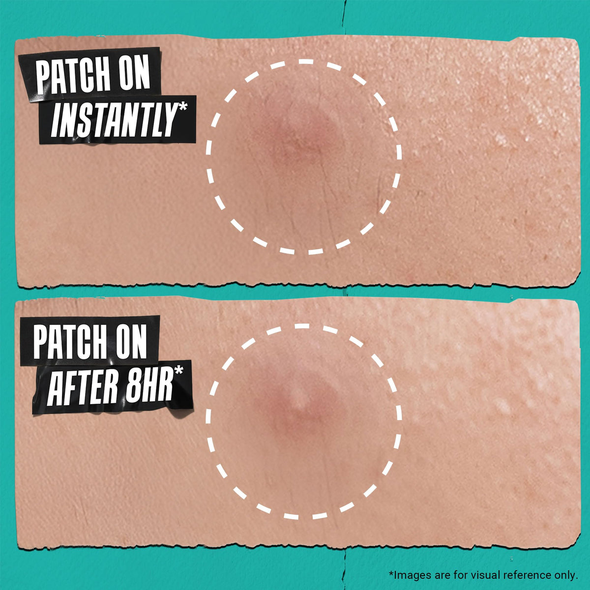 Rosy Brown Kiehl's - Overnight Pimple Patches - Invisible Blemish Patch - 22 Count