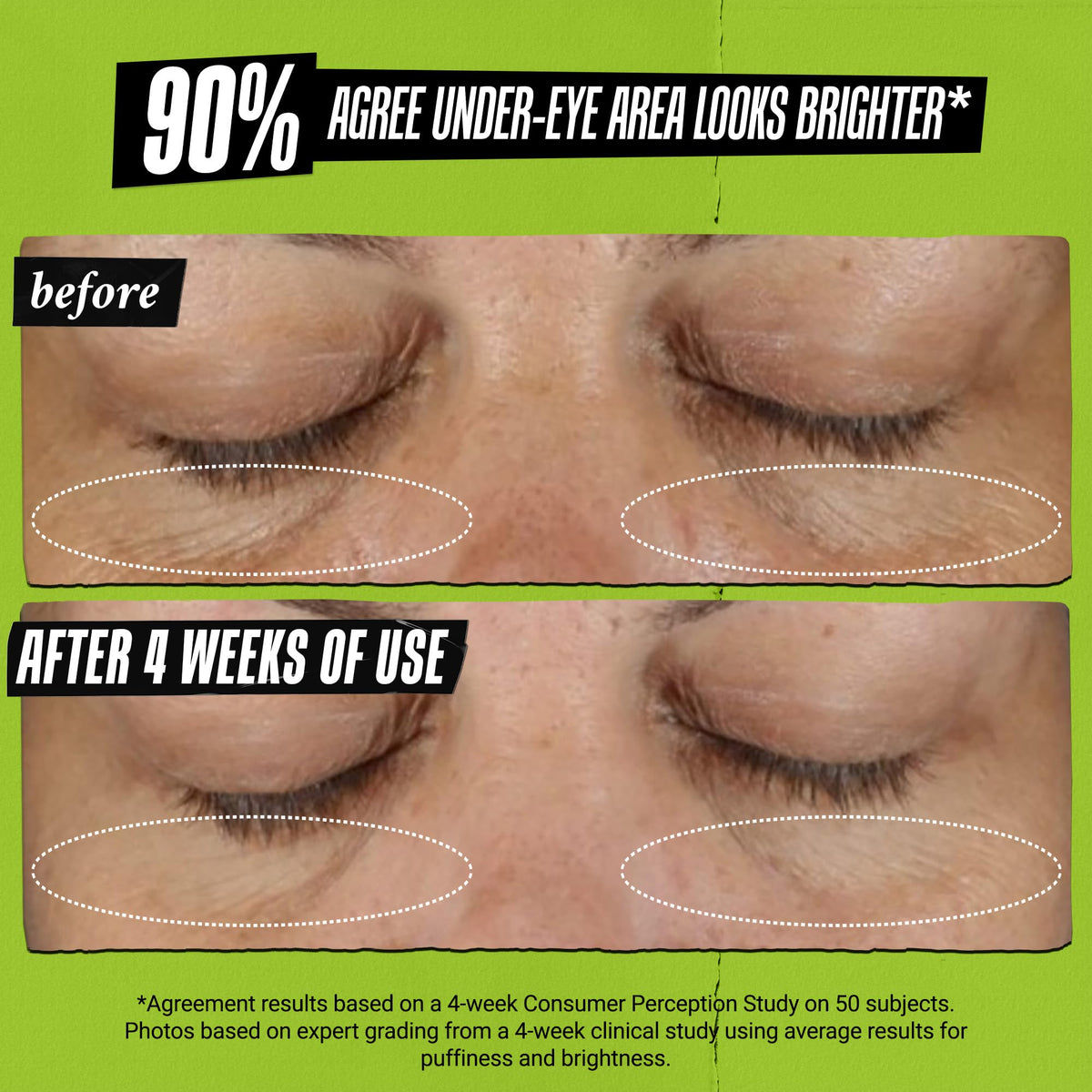 Rosy Brown Kiehl's - Avocado Eye Treatment, for Dry Lines & Puffiness - 0.5 fl oz