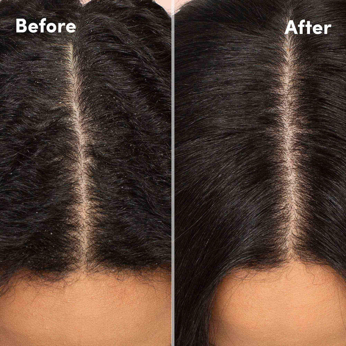 Black MIZANI Scalp Care Dandruff Shampoo - Cleanses Hair & Scalp, For Curly Hair