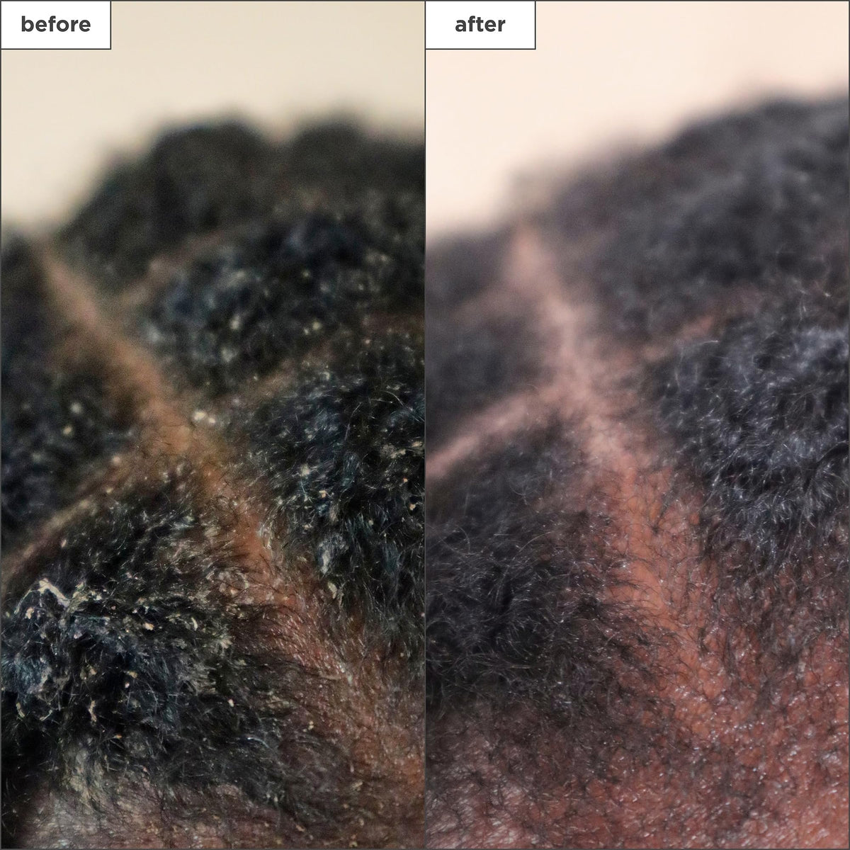 Dark Slate Gray Briogeo Scalp Revival Charcoal + Tea Tree Scalp Treatment | Leave-In Serum