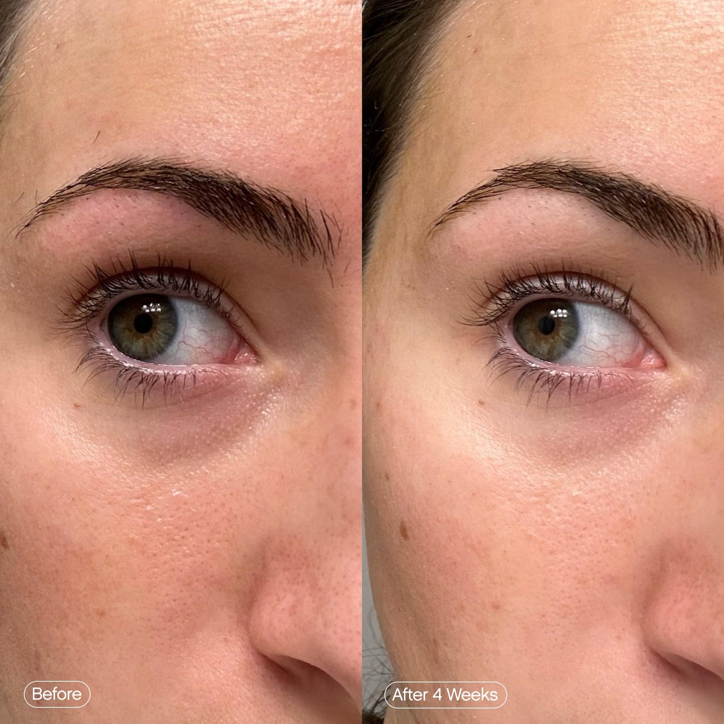 Tan Topicals Faded Brightening Under Eye Masks | Patches to Depuff, Hydrate, Brighten and Cool | Reduce Dark Circles and Fine Lines | Contains Kojic Acid, Caffeine and Niacinamide (Set of 6)