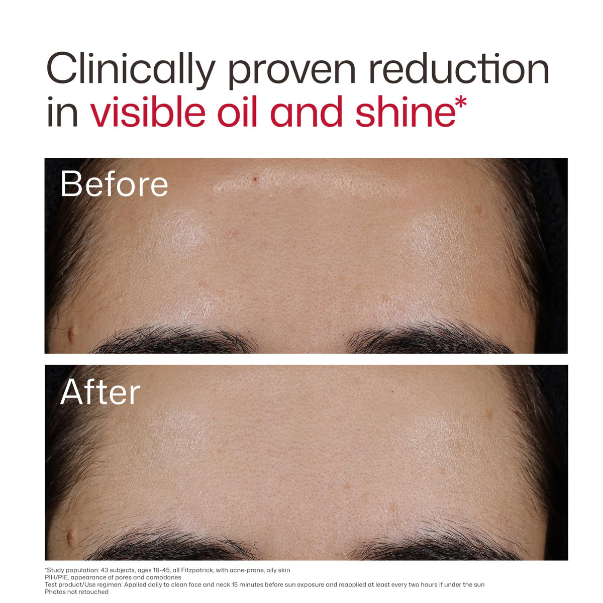 Rosy Brown EltaMD UV Clear Blemish-Prone and Oil Balancing, Untinted, SPF 50, 0.5 oz