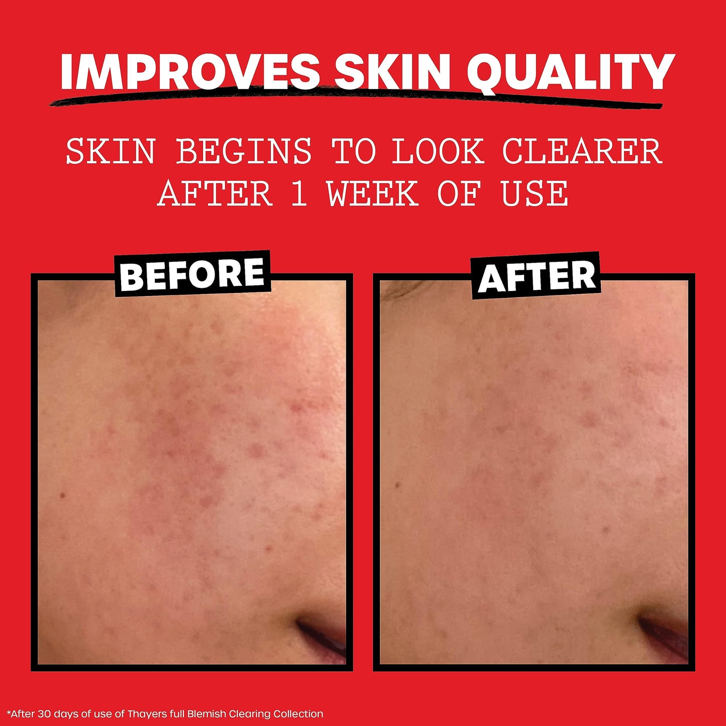 Rosy Brown THAYERS Witch Hazel Blemish Cleanser, 4 Ounce