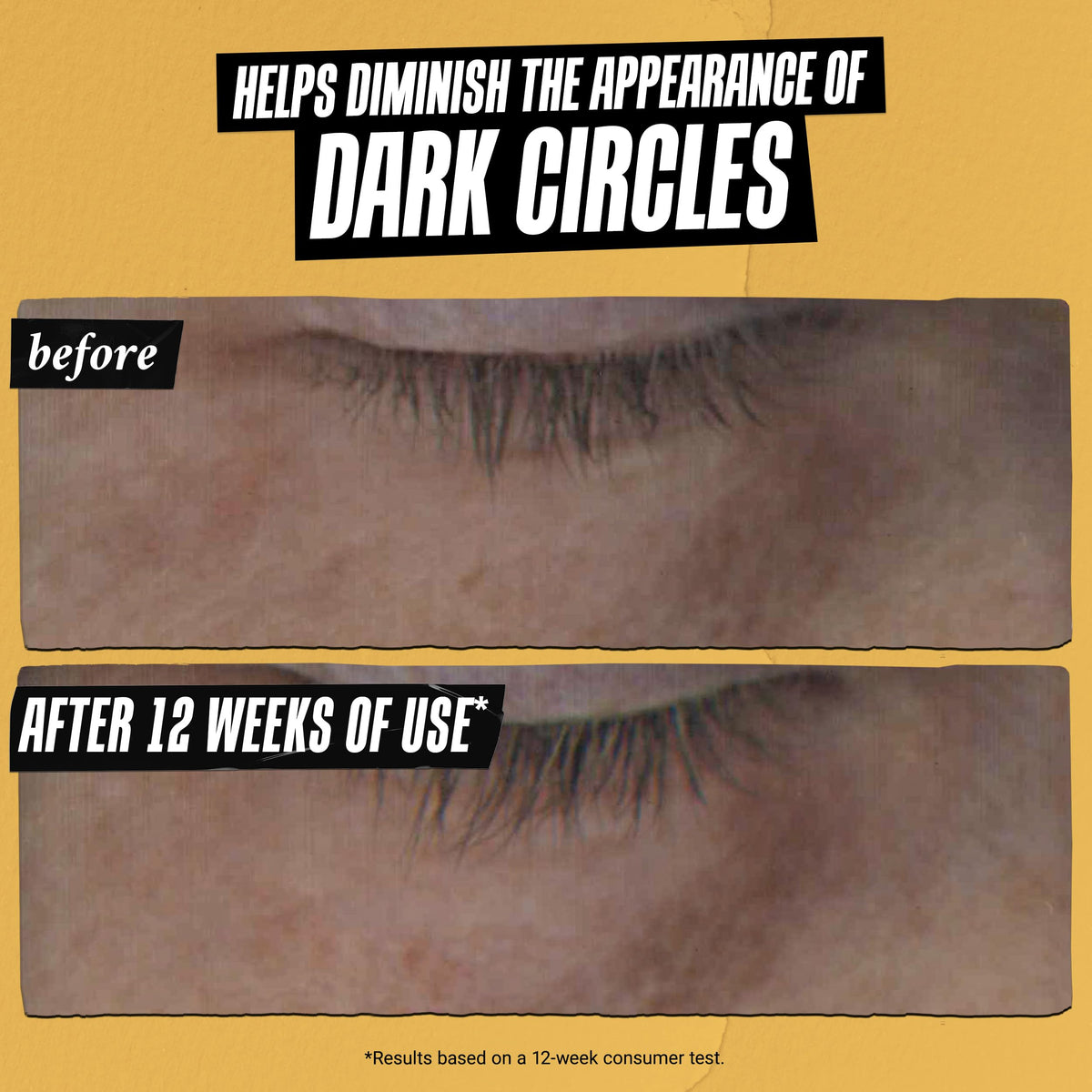 Dim Gray Kiehl's - Powerful-Strength Eye Serum - Reduces Dark Circles - 0.5 fl oz