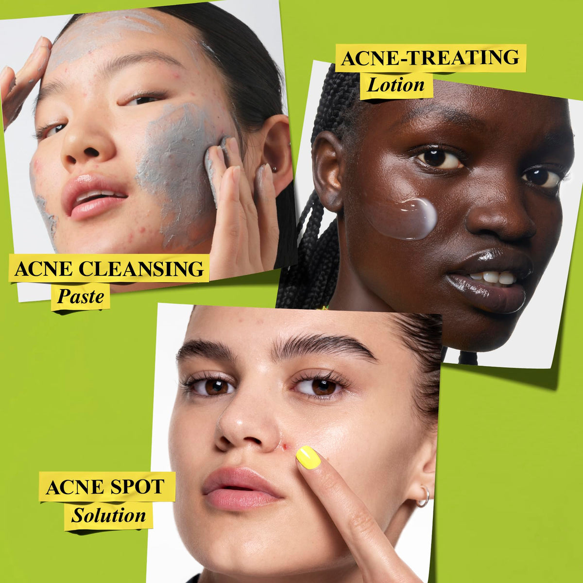 Yellow Green Kiehl's - Acne Skincare Routine Gift Set - Clears Acne - 3pk