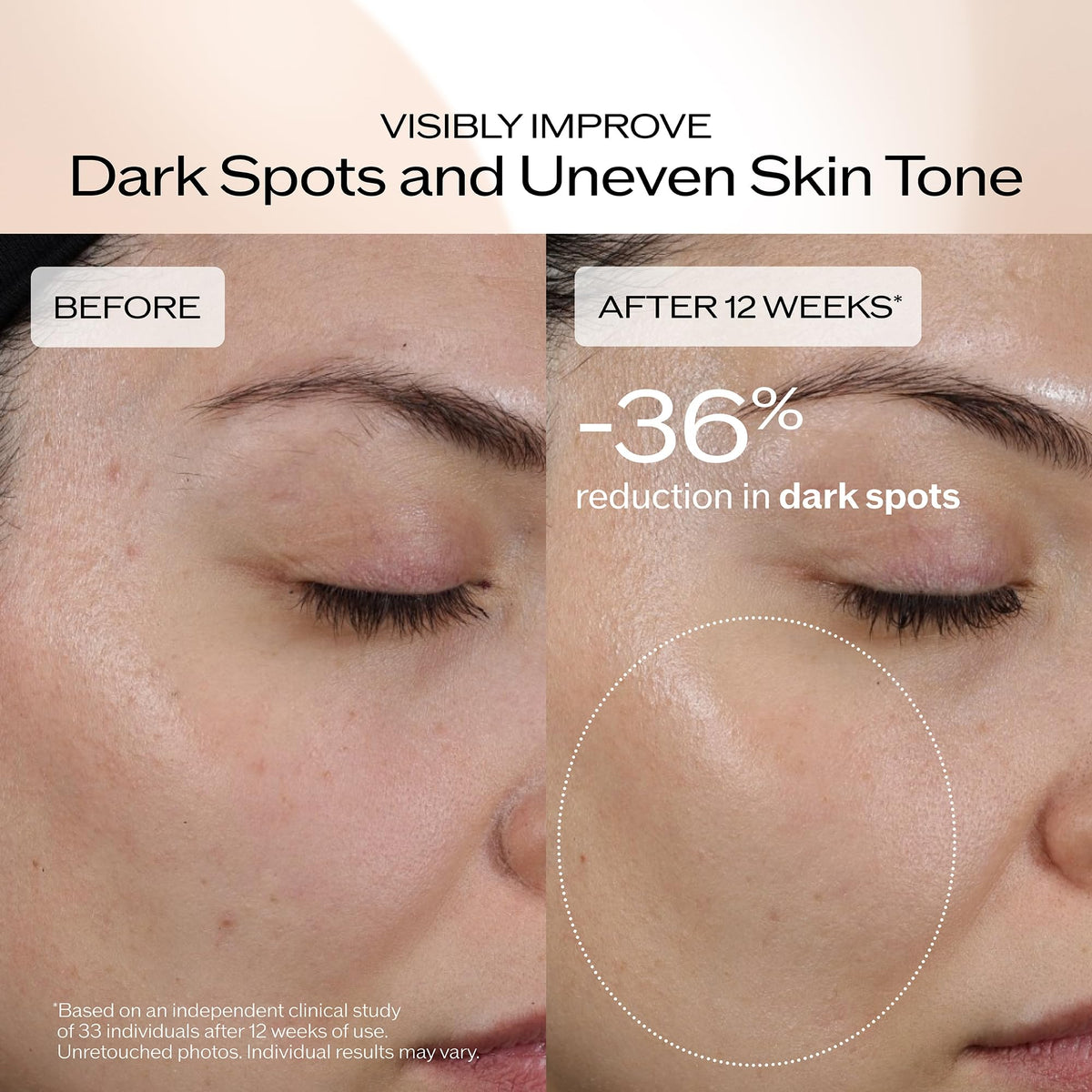 Rosy Brown Shiseido Benefiance Dark Spot and Wrinkle Smoothing Face Serum - 30 mL - Visibly Improves Dark Spots & Wrinkles with Niacinamide & Plant-Based Retinol - 8HR Hydration - Non-Comedogenic, All Skin Types