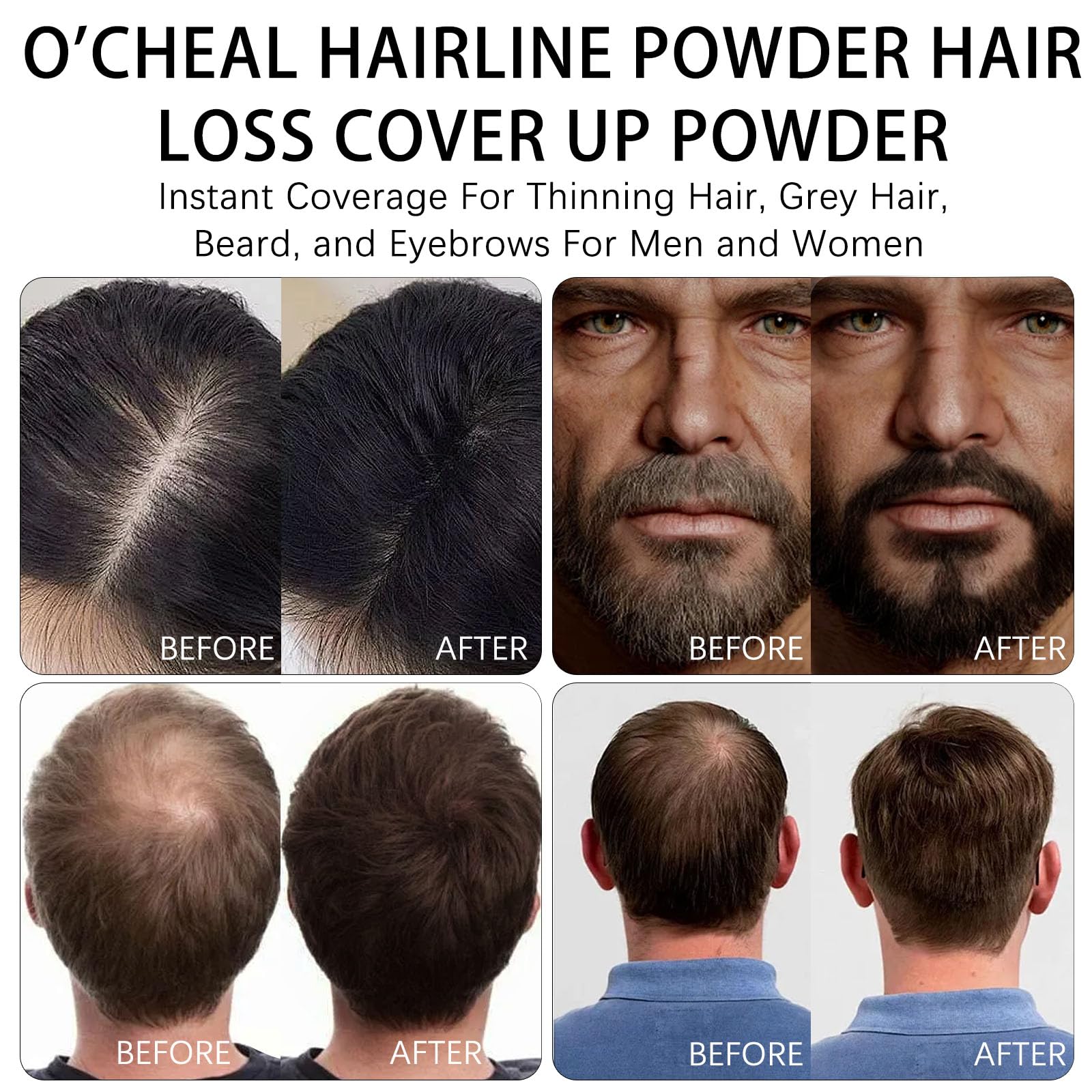 White Smoke O'CHEAL Hairline Powder Dark Brown, Waterproof Hair Fibers for Thinning Hair, Instantly Root Touch Up Hair Color for Gray Hair Coverage, Long Lasting Hair Line Shadow Toppers Powder for Men and Women