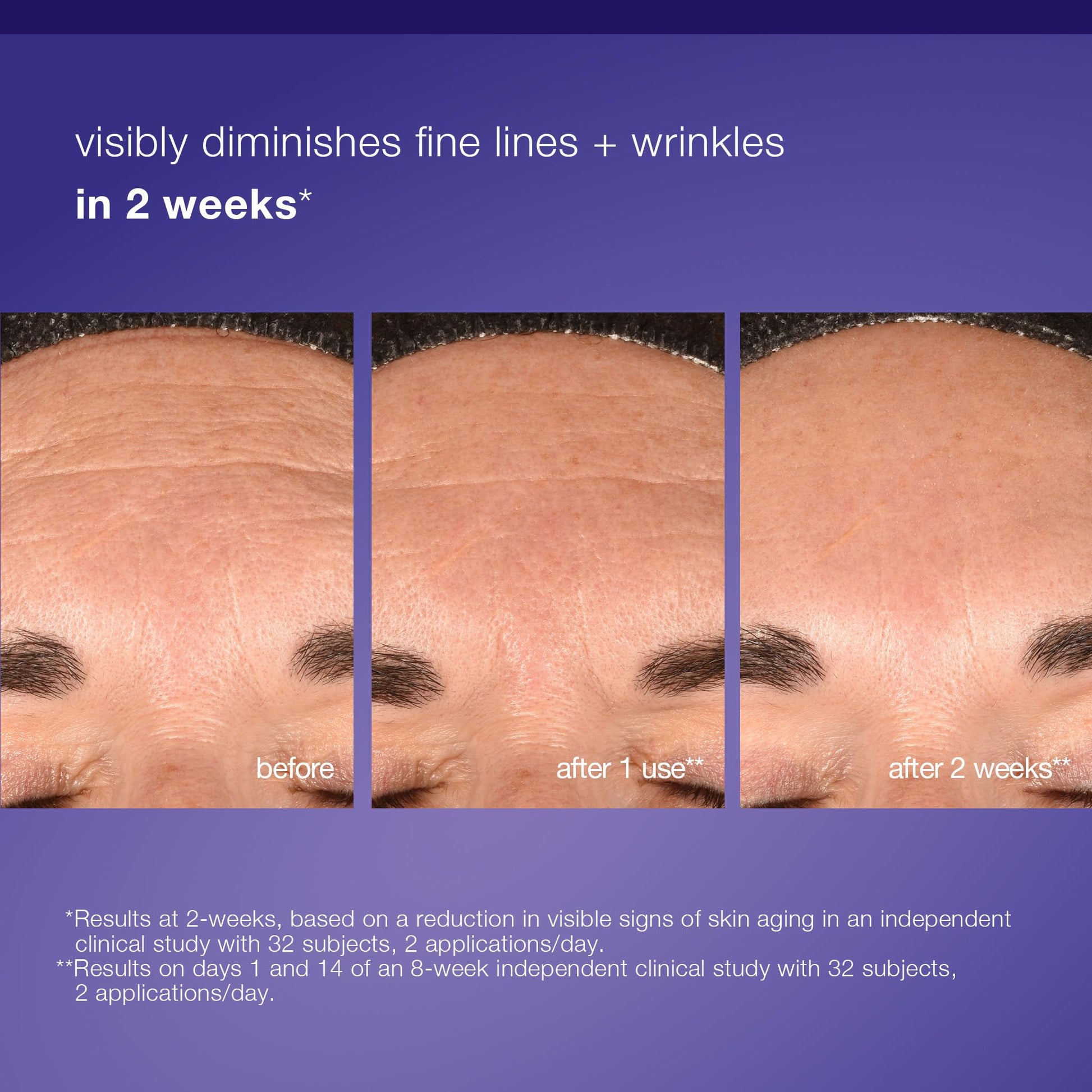 Dark Slate Blue Dermalogica Phyto Nature E2, Daily Leave on Face Exfoliant for Skin Renewal, Exosome Pre Serum, 3.4 fl oz