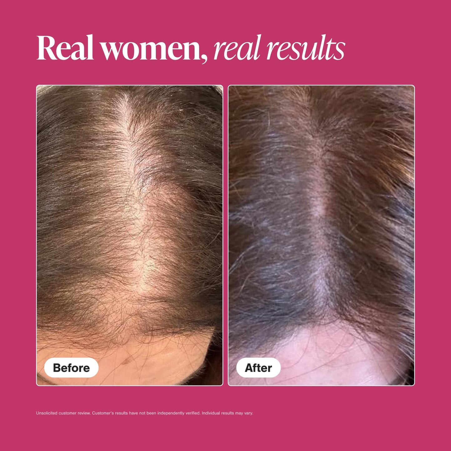 Maroon Viviscal Hair Growth Supplements for Women, Thicker Fuller Hair Support for Thinning Hair and Hair Loss, with Biotin and Marine Collagen, Drug-Free, 180 Tablets, 90-Day Supply