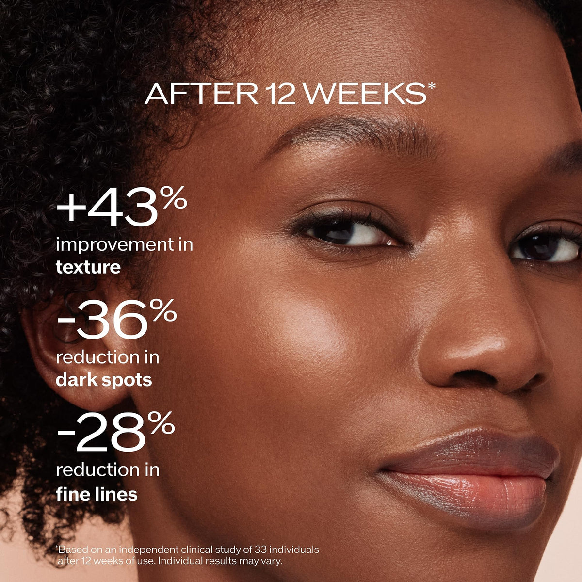 Black Shiseido Benefiance Dark Spot and Wrinkle Smoothing Face Serum - 30 mL - Visibly Improves Dark Spots & Wrinkles with Niacinamide & Plant-Based Retinol - 8HR Hydration - Non-Comedogenic, All Skin Types