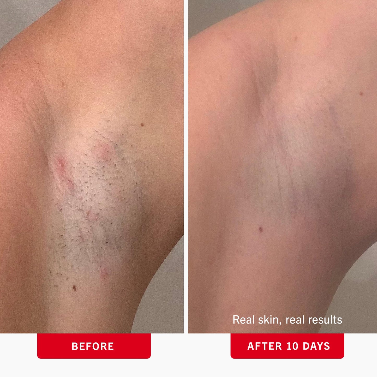Rosy Brown First Aid Beauty - Ingrown Hair Pads with BHA + AHA - Aftershave Treatment Pads to Help Prevent Razor Bumps for Men & Women - Exfoliate Underarms & Bikini Area - Compostable for Daily Use - 28 Pads