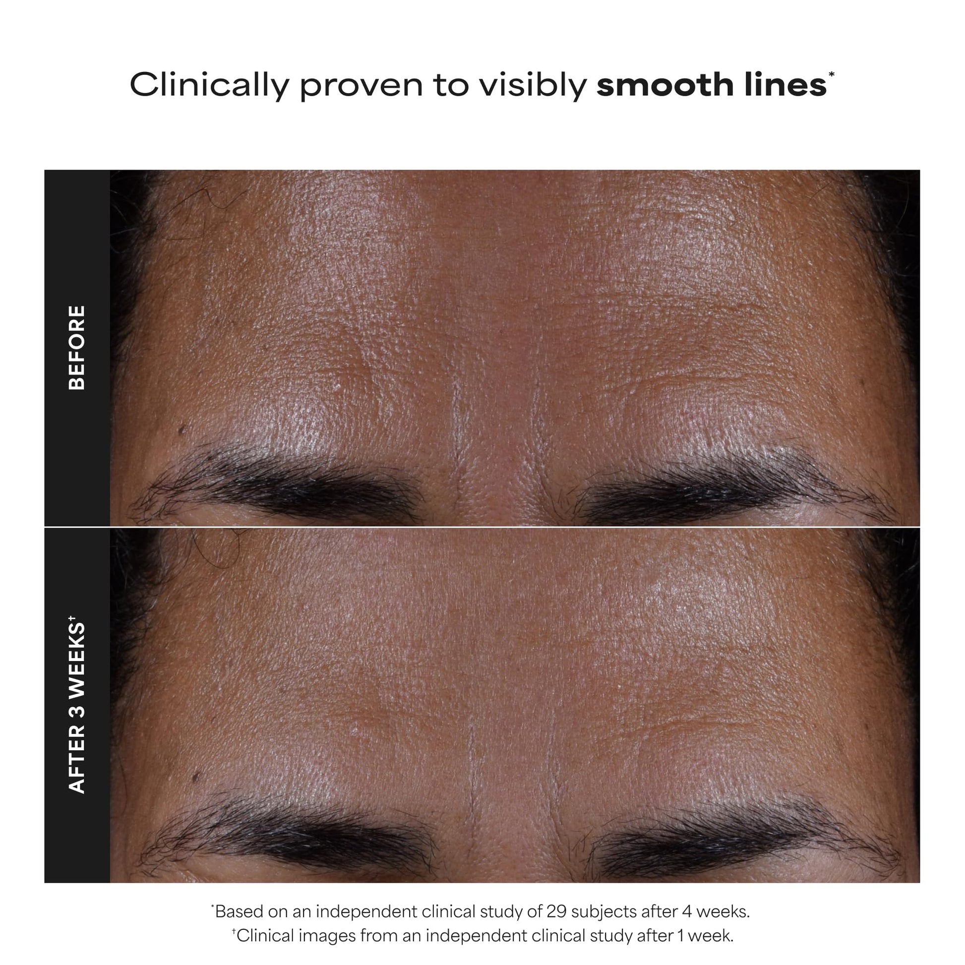 Dim Gray Paula's Choice Skin Perfecting 2% BHA Liquid Salicylic Acid Exfoliant, Gentle Facial Exfoliator for Blackheads, Large Pores, Wrinkles & Fine Lines, Travel Size, 1 Fluid Ounce