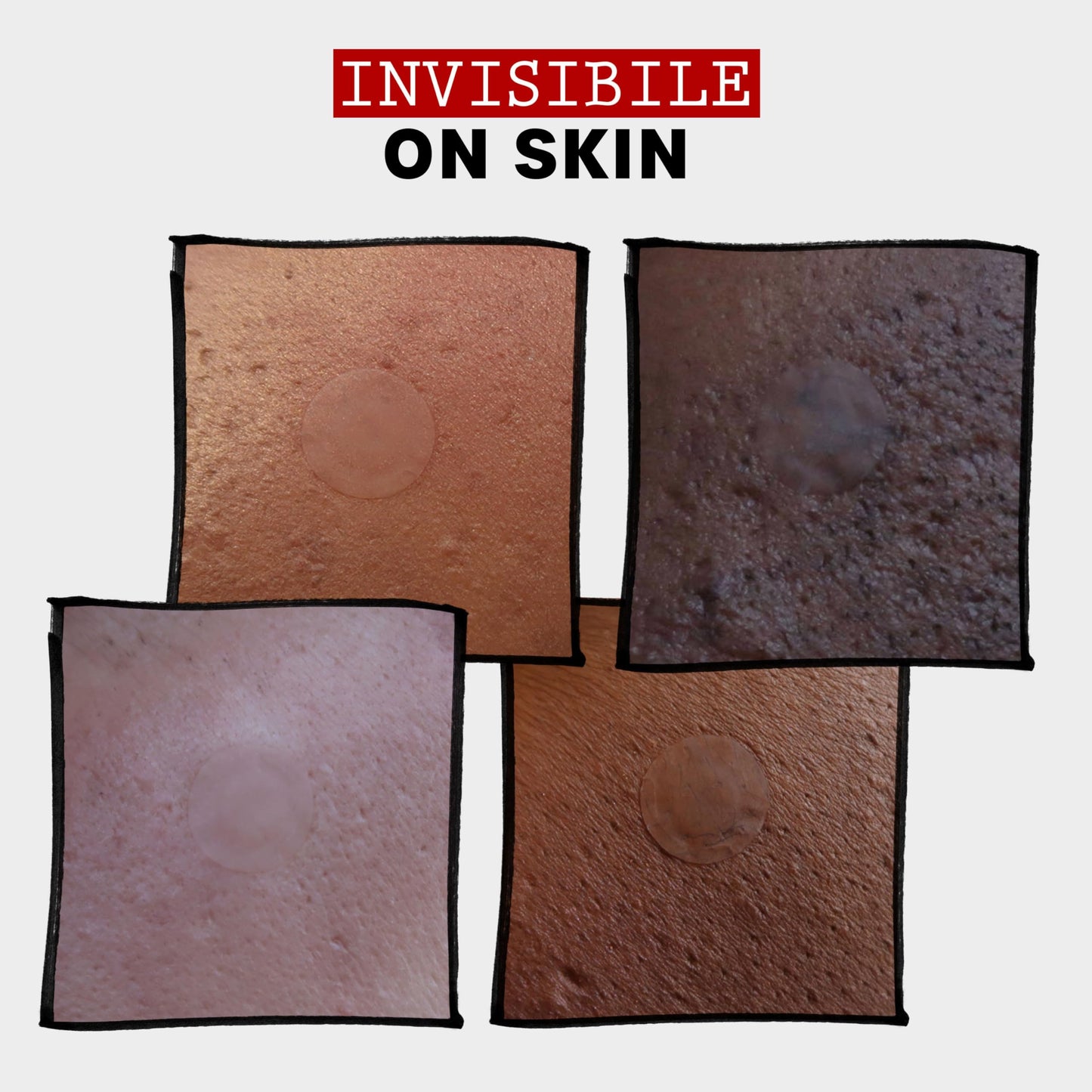 Lavender THAYERS Invisible S.O.S Hydrocolloid Acne Pimple Patch, Ultra-Thin Design Instantly Reduces Look of Blemishes, Set of 22 Pimple Patches
