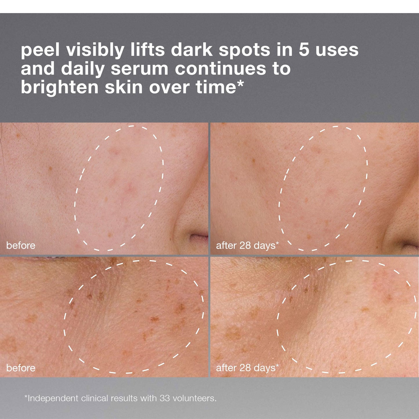 Rosy Brown Dermalogica PowerBright Dark Spot System Skin Care Kit, Includes Face Serum and Peel - Fade, Lift, and Prevent Dark Spots and Hyperpigmentation
