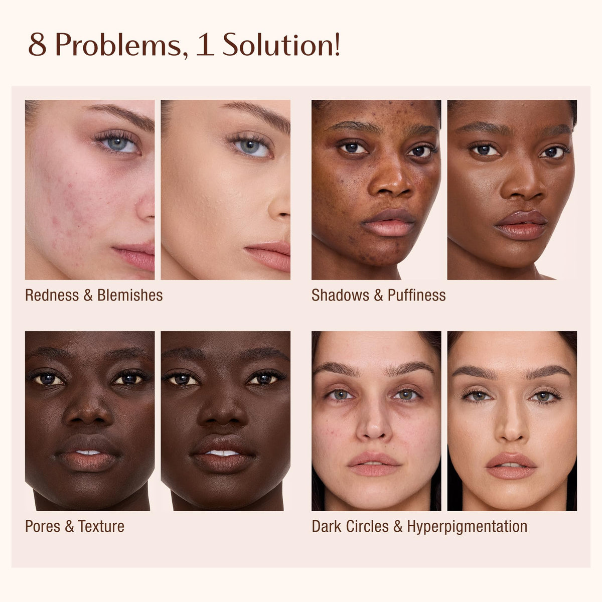Misty Rose Charlotte Tilbury AIRbrush Flawless Blur Concealer - Longwear Concealer for Dark Circles, Blemishes, Redness & More - Hydrating, Crease-Proof & Full Coverage with a Natural Matte Finish