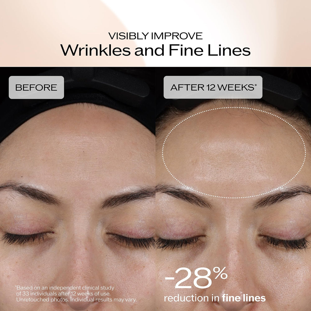 Rosy Brown Shiseido Benefiance Brightening & Smoothing Serum Set - $140 Value