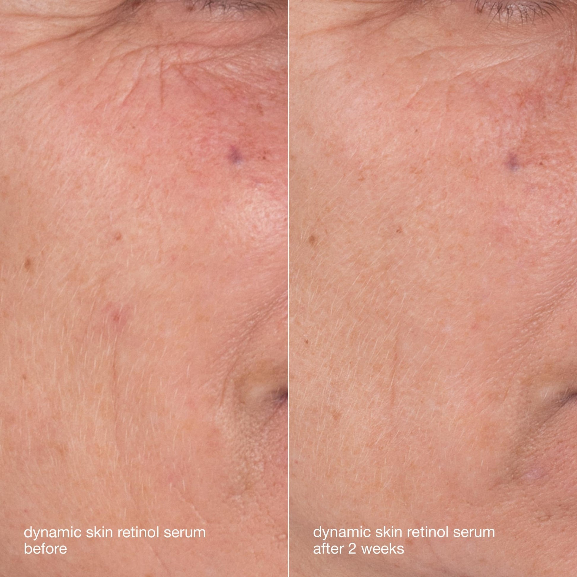 Dark Salmon Dermalogica Skin Aging Solutions Kit, Anti Aging Skincare Set - Includes: Face Cleanser, Serum, Moisturizer with SPF, and Cream, Travel Size