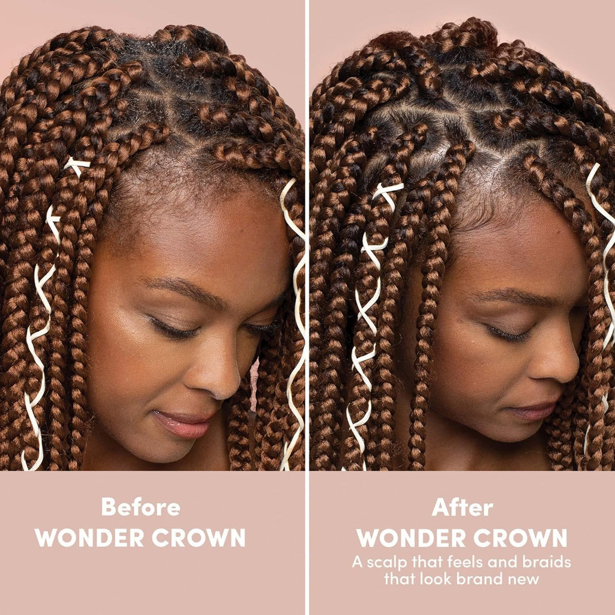 Gray Mizani Wonder Crown Scalp Cleanser – For Dry Scalps