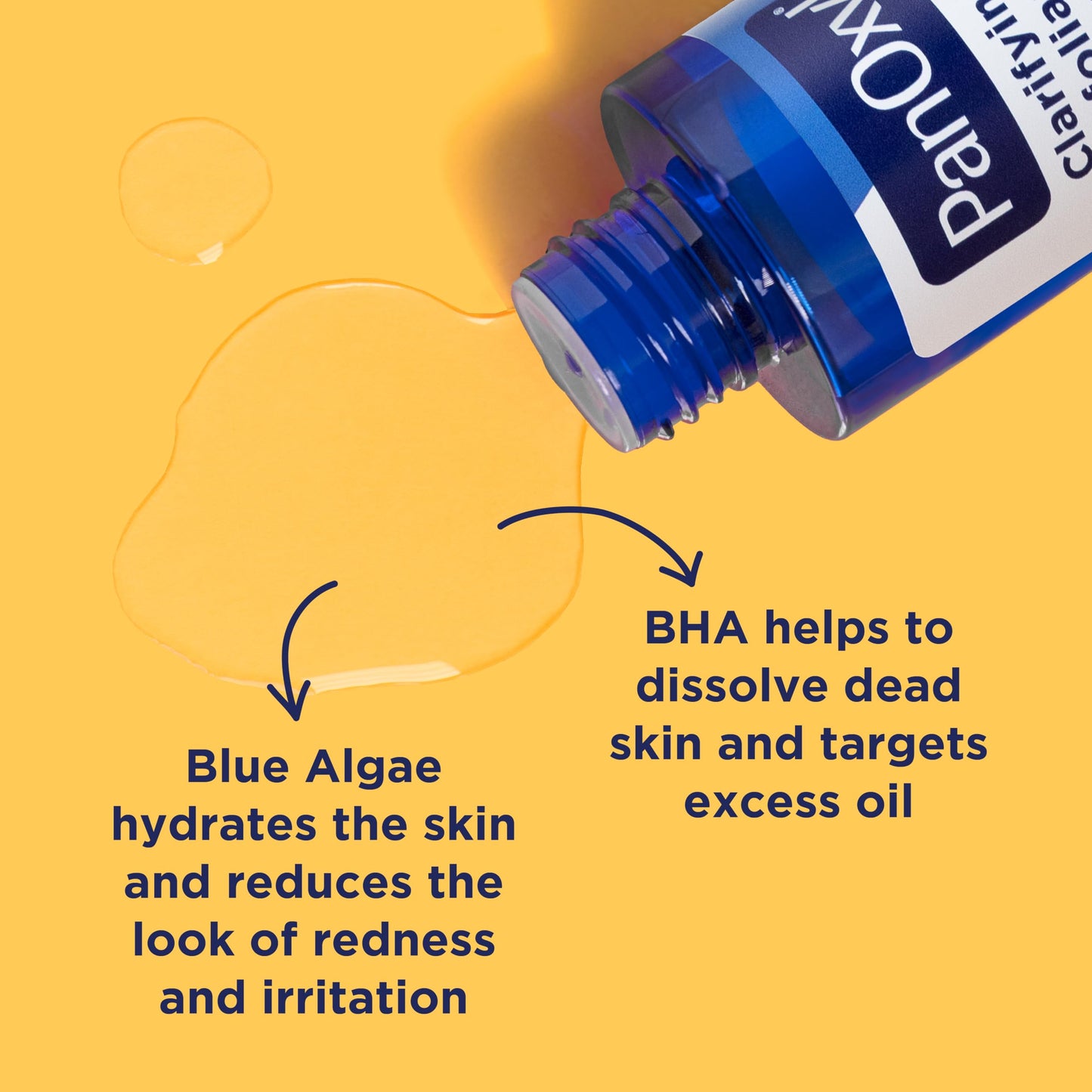 Sandy Brown PanOxyl Clarifying Exfoliant with 2% Salicylic Acid, BHA Liquid Exfoliant for Face, Unclogs, Minimizes Appearance of Pores, Blue Algae and Antioxidants Help Calm Redness, For Acne Prone Skin, 4 fl oz