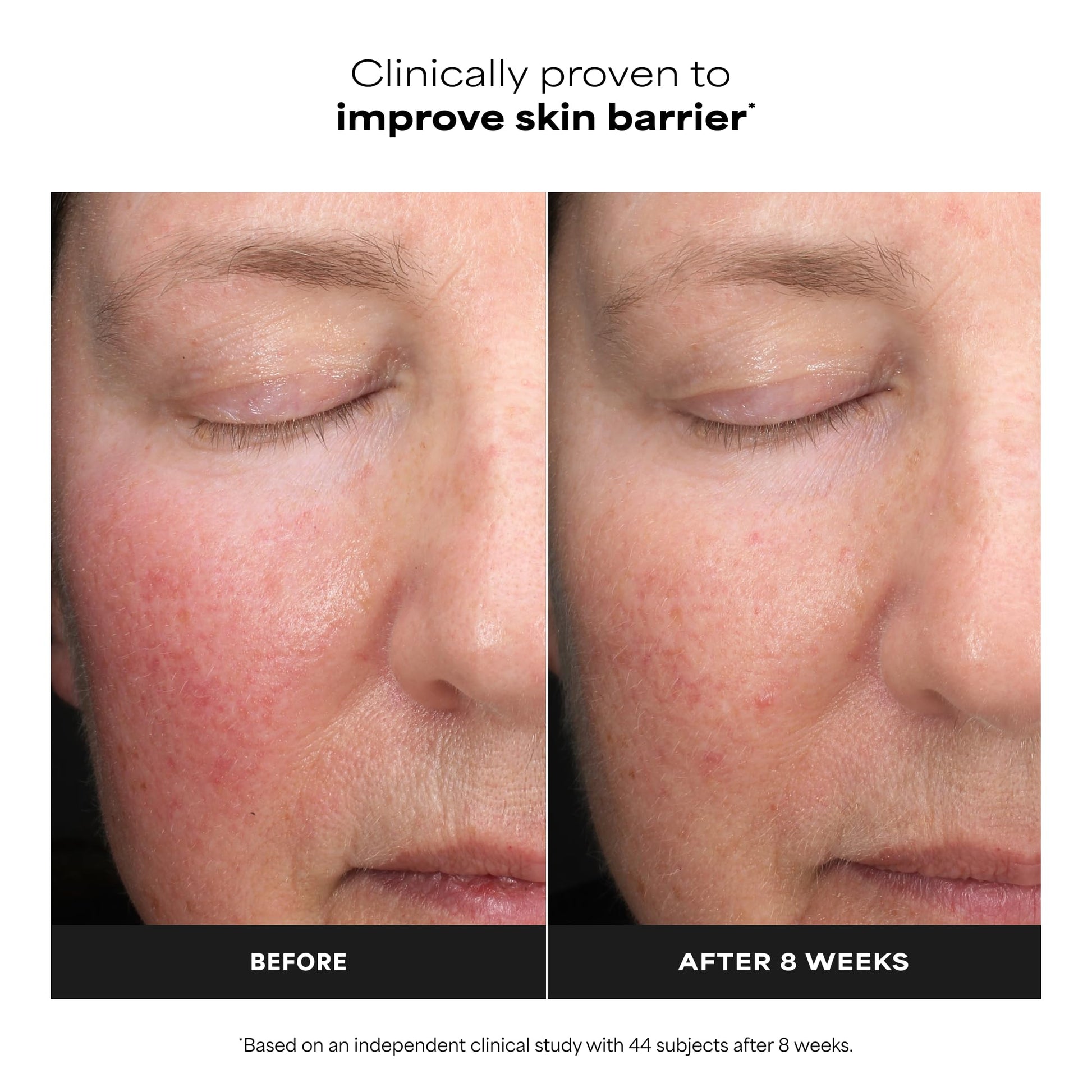 White Smoke Paula’s Choice Liquid Face Exfoliant 6% Mandelic Acid + 2% Lactic Acid Exfoliant, Gentle Daily AHA Exfoliation for Discoloration, Bumpy Texture & Radiance, for Sensitive Skin, Fragrance-Free, 1 fl oz