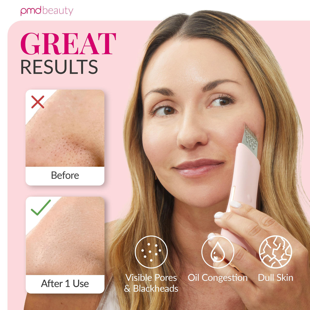Misty Rose PMD Wave Pro Skin Spatula, Professional-Grade Facial Skin Care Products, Blackhead Remover Tools with SonicGlow, E-Wave, Clear Pores, Blackheads and Whiteheads, Blush