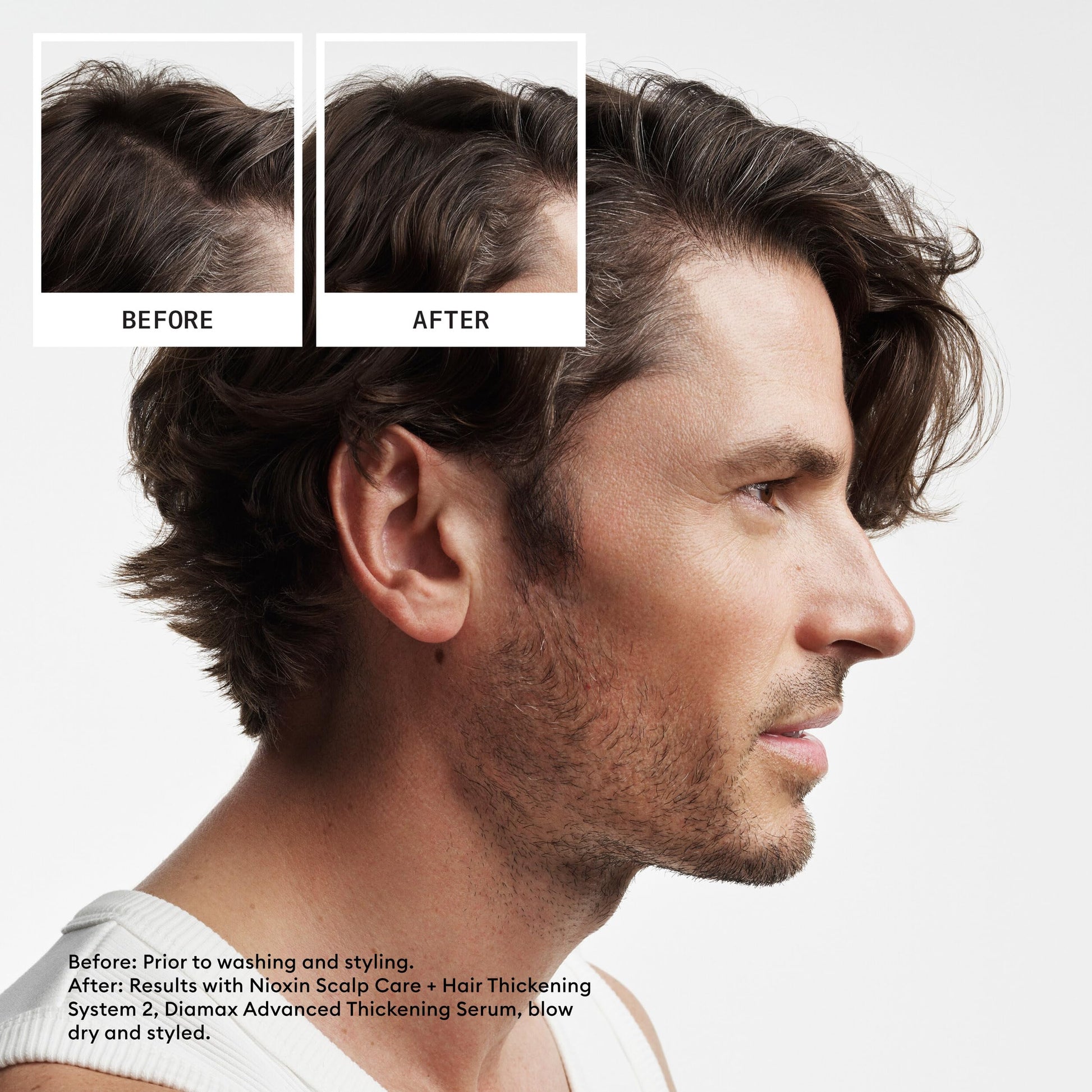 White Smoke Nioxin Scalp + Hair Thickening System 2 | For Natural Hair with Progressed Thinning | Boost Hair Density with Niacinamide & Biotin | Trial Size | 1 Month Supply