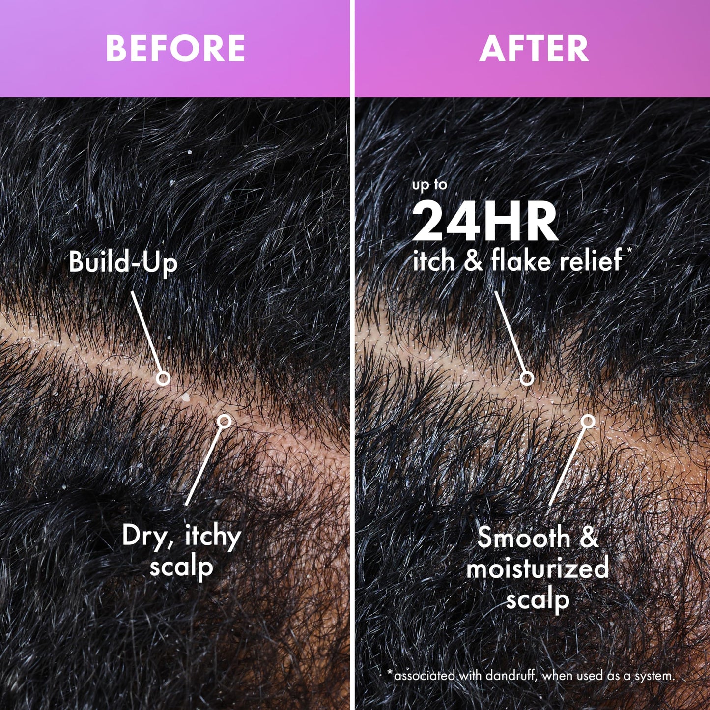 Black Mielle Organics Lavender & Lychee Scalp & Hair Build-Up Remover, Clarifying Pre-Shampoo Treatment for Product Build Up, Dirt & Oil, With Niacinamide, Castor Oil & Lavender Extract, 4 fl oz